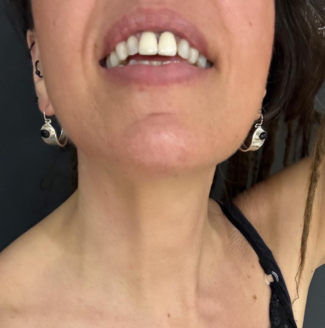 CERCHI CON PIETRA ONICE - ARGENTO 925