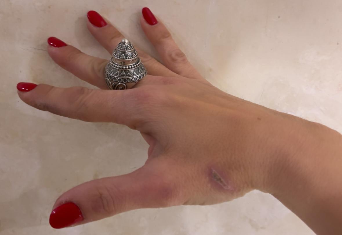 ANELLO DECORATO ARGENTO 925